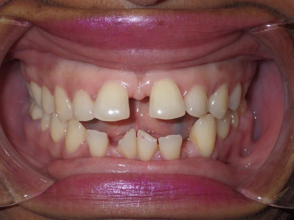 Before-patient 5