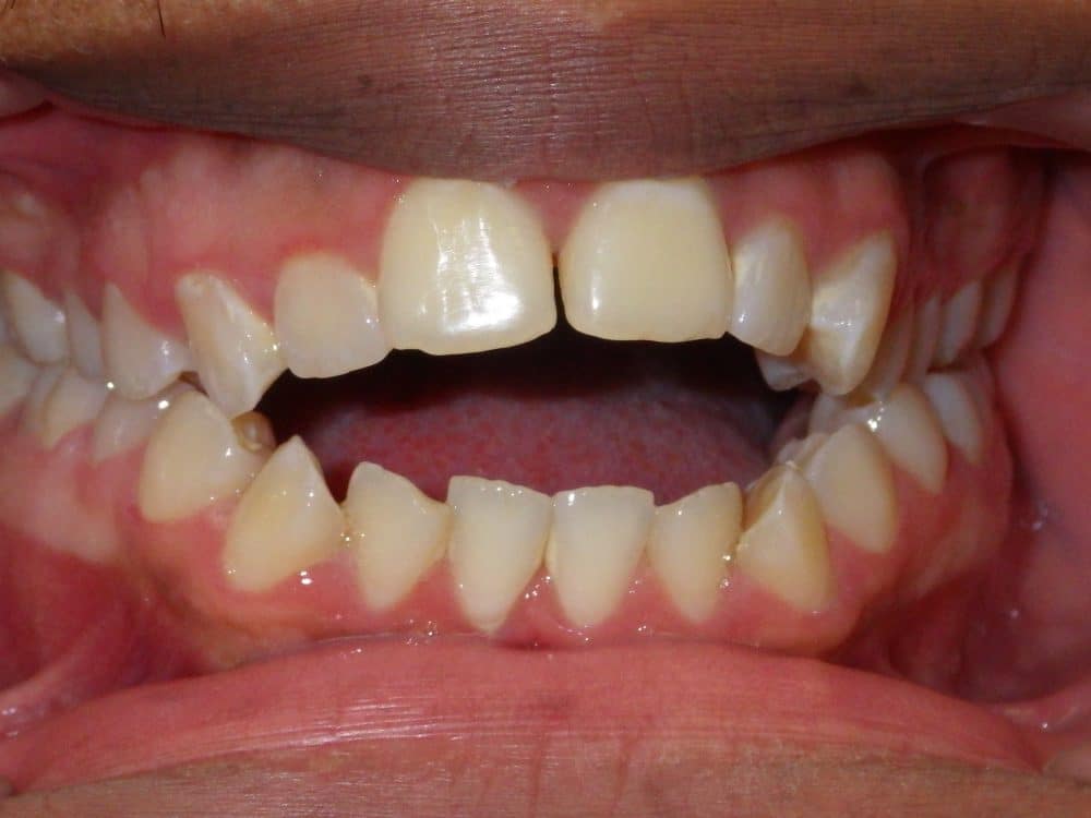 Before-patient 9