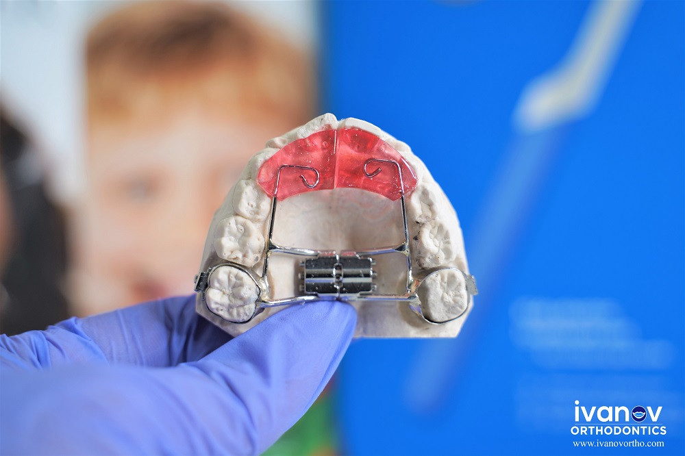 The Importance of Phase 1 Orthodontic Treatment: EZ Dental: Family