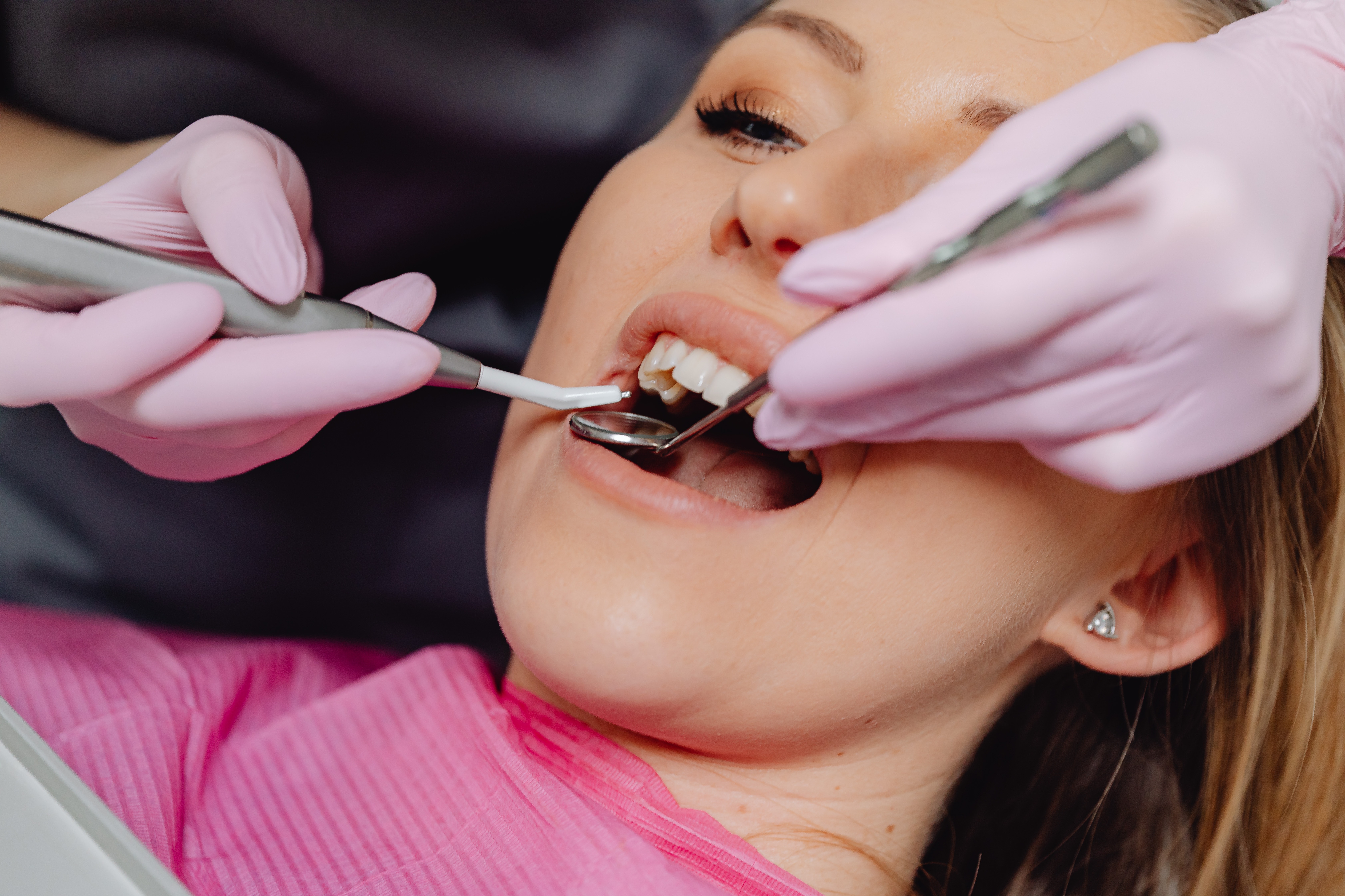 What To Expect From a Deep Teeth Cleaning