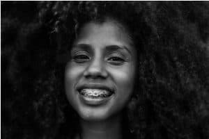 free orthodontic consultation