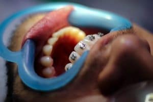 best-orthodontist