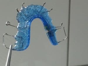 retainers cost