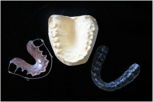Retainer replacement