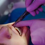 getting braces tightened