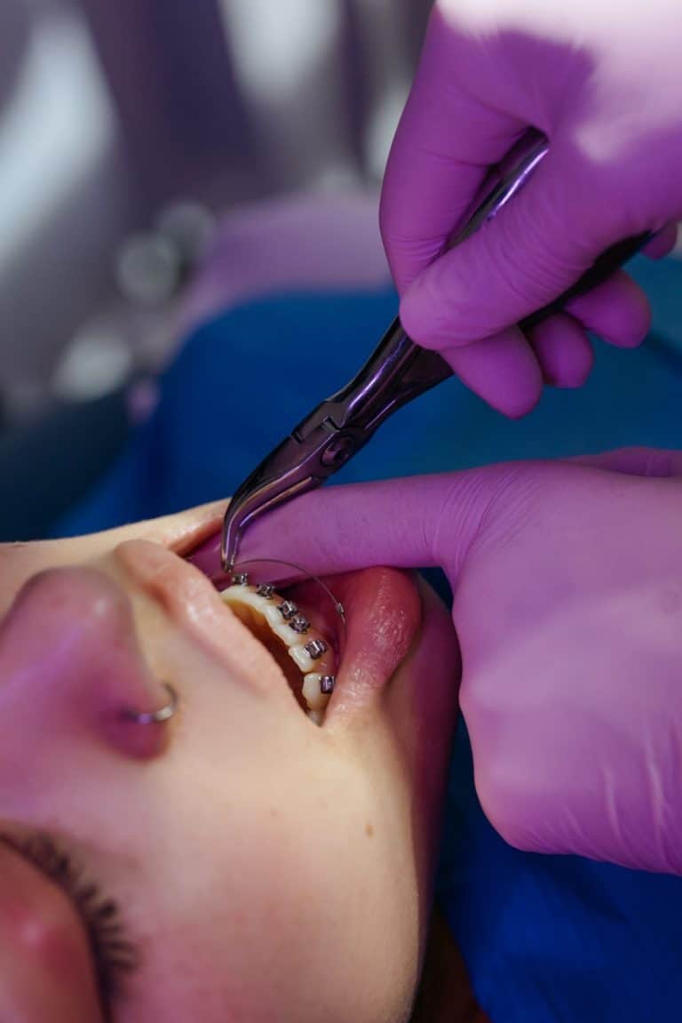 getting braces tightened