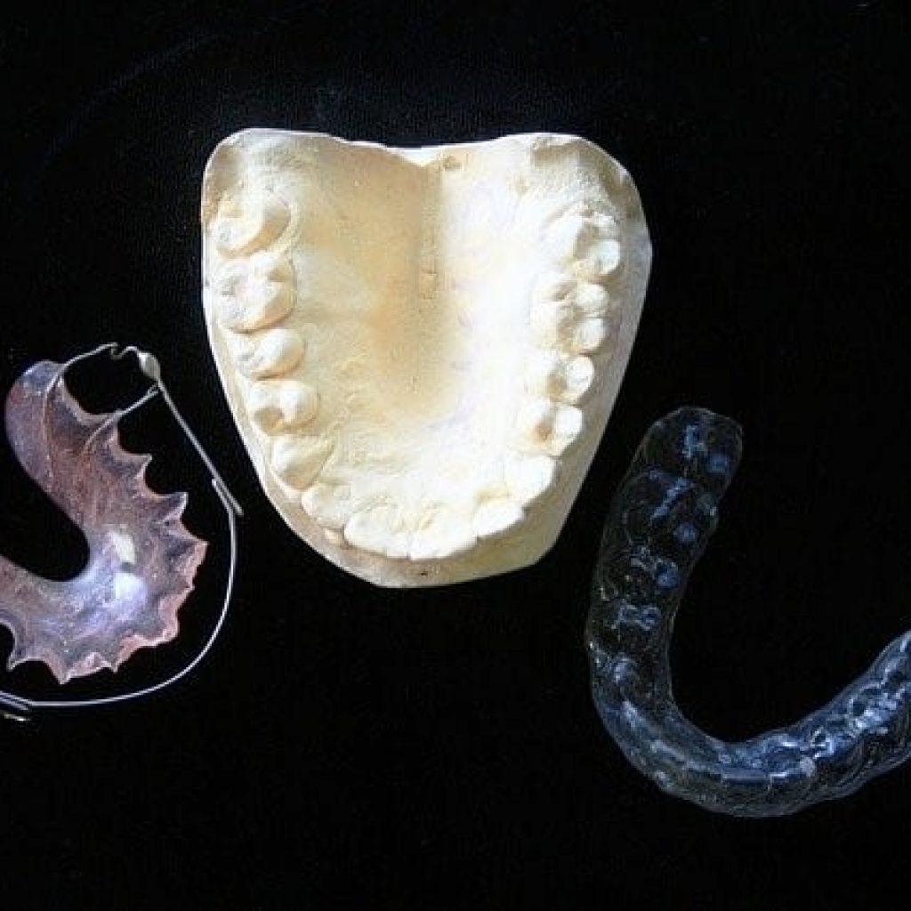 How Much Are Retainers Cost? Ivanov Orthodontist