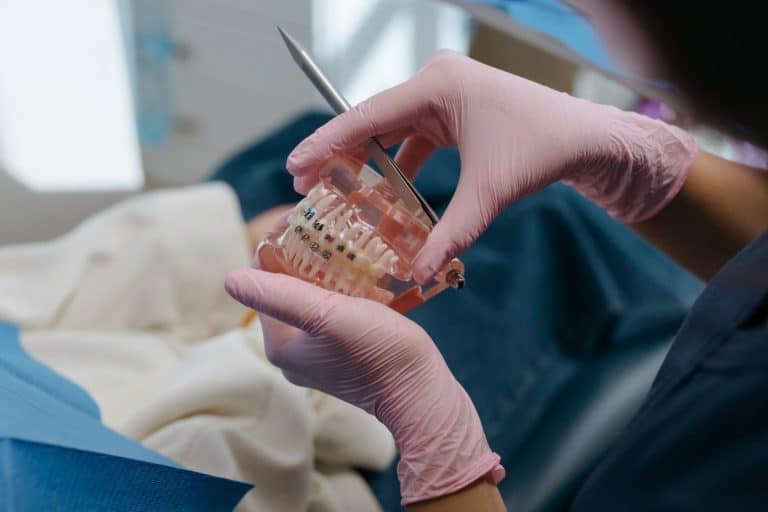 what are the different types of braces