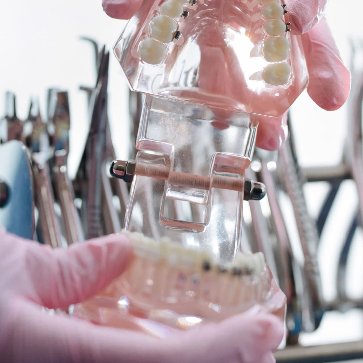 Orthodontic Spacers Braces Miami Dental Spacers For Teeth