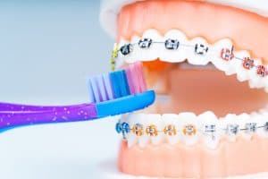 delta-dental-orthodontics-near-me
