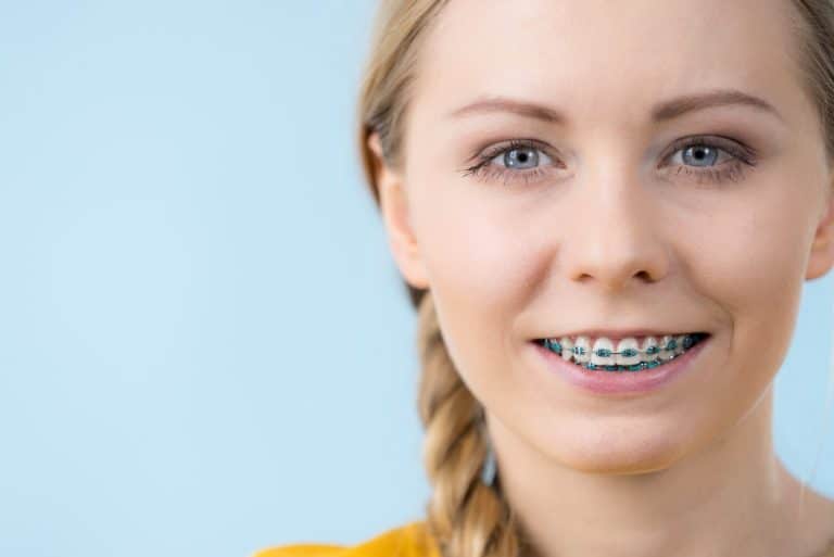 Getting Braces And What You Should Know Ivanov Orthodontic