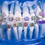the-best-orthodontist-near-me
