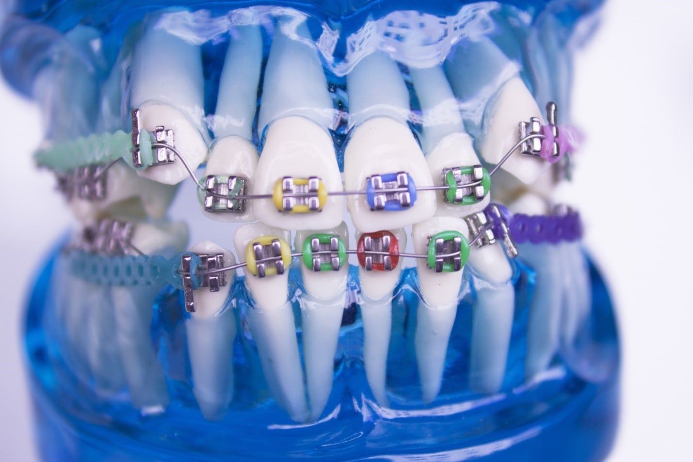 the-best-orthodontist-near-me