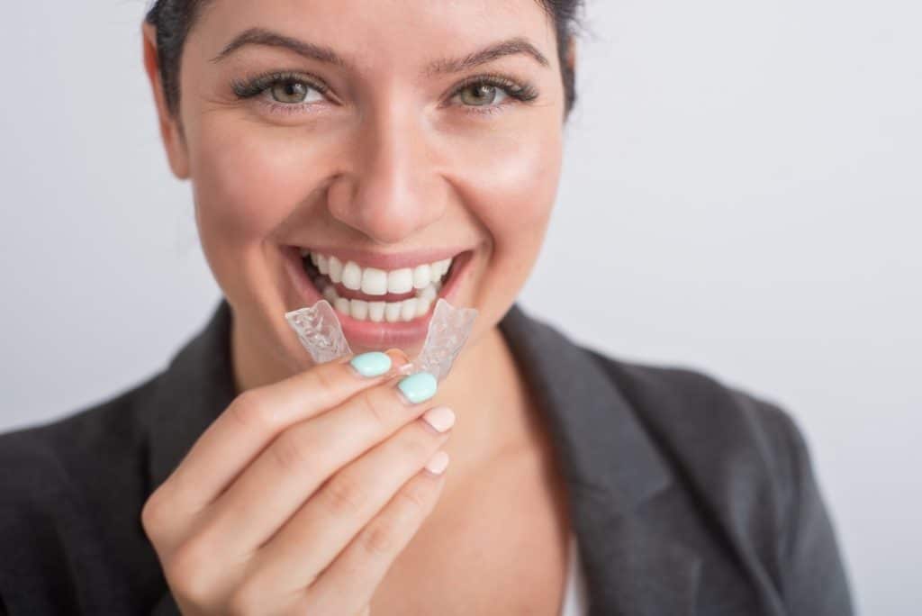Clear Braces for Miami Adults