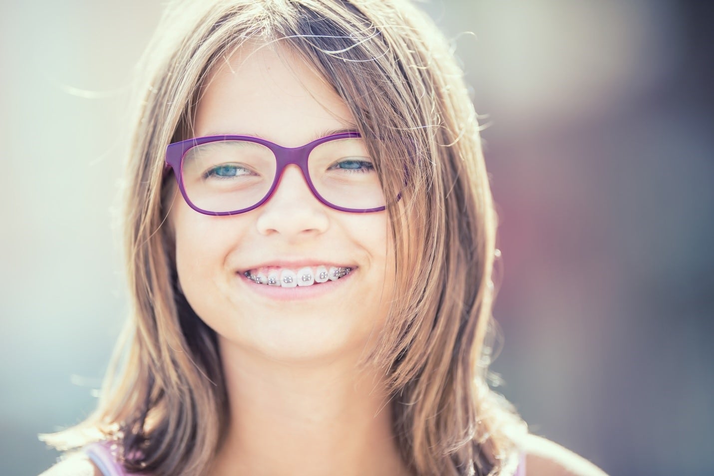 get-braces-today-near-me