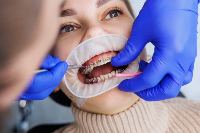 orthodontist consultation