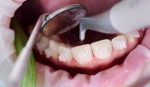 Orthodontist near you