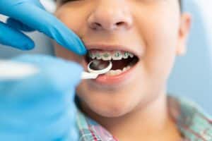 Orthodontist that take insurance