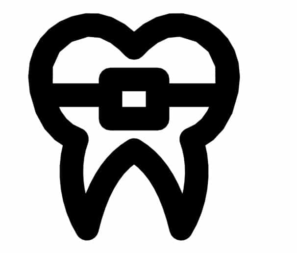 Molar bands for Braces Miami Metal bands braces Miami, Fl