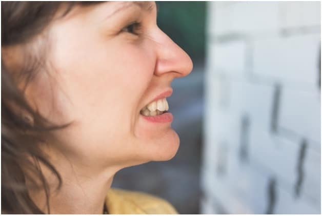 fix buck teeth