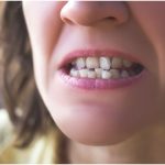 Crooked Bottom Teeth