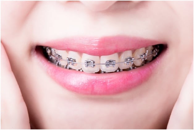 Orthodontist Hollywood FL | Clear Braces & Invisalign Hollywood