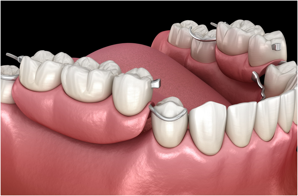 Teeth Flippers