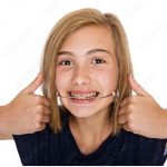 Functional Orthodontic Appliance