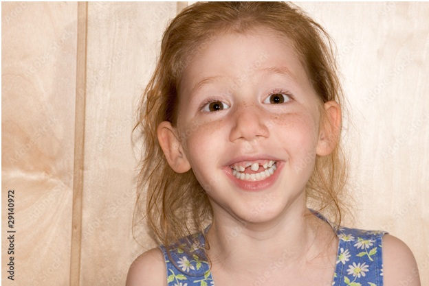 Snaggle Tooth
