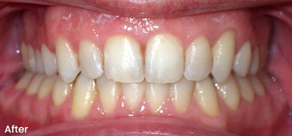 Bagdan S After Treatment