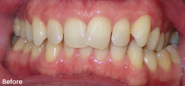Bagdan S Before Treatment