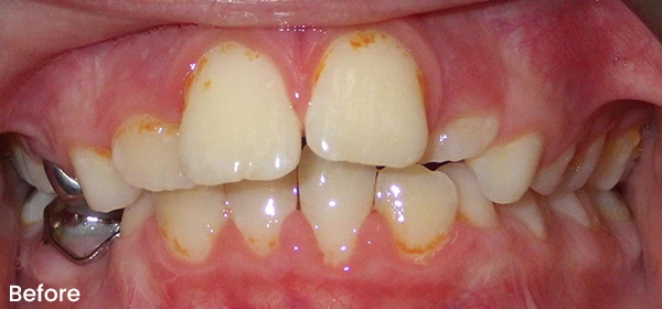 David C Before Treatment
