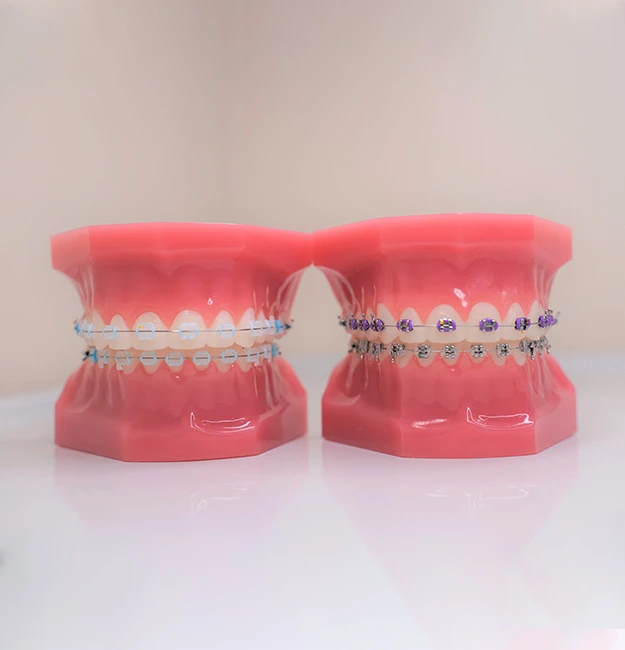 Braces