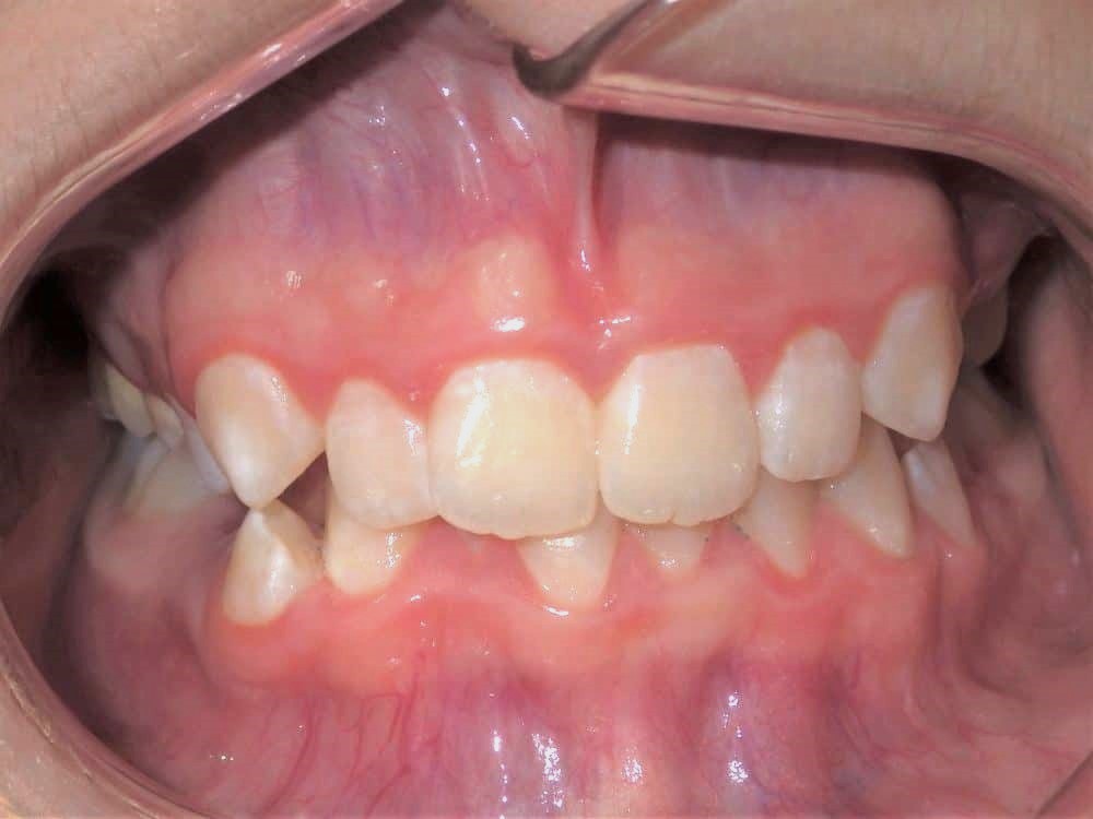 Before-patient 6