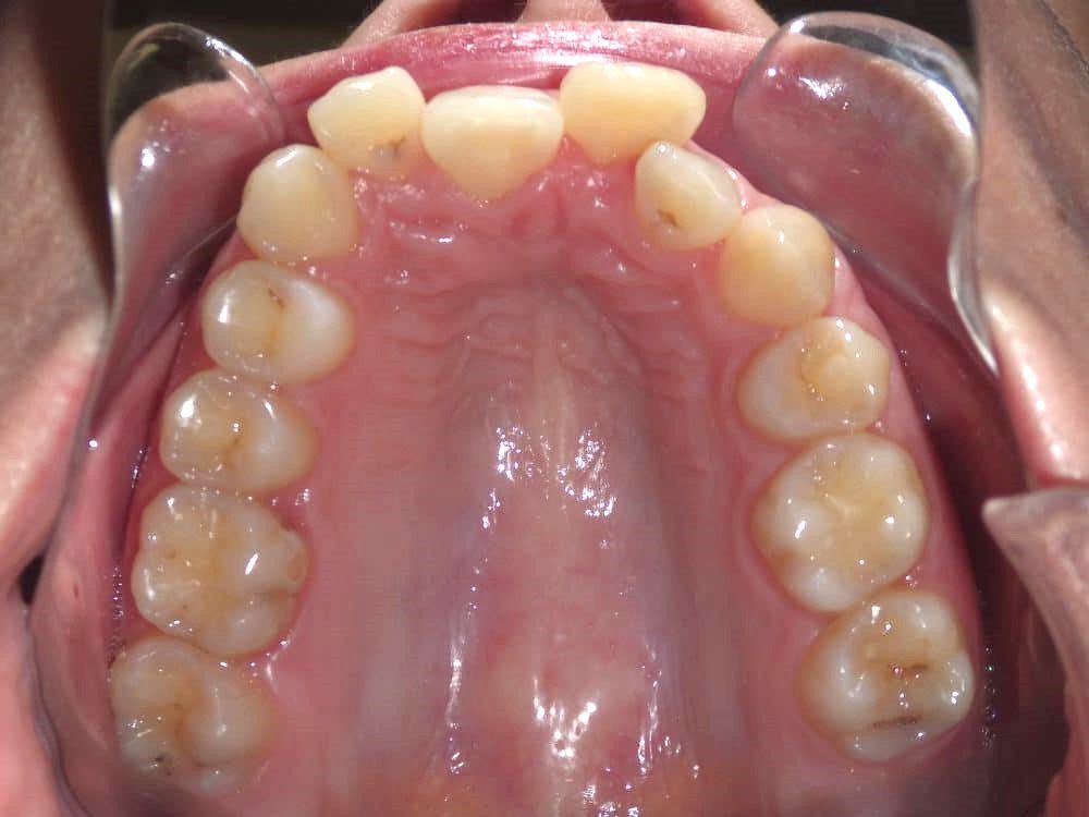 Before-patient 4