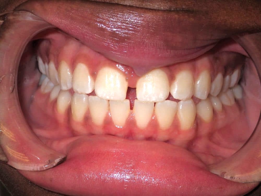 Before-patient 7
