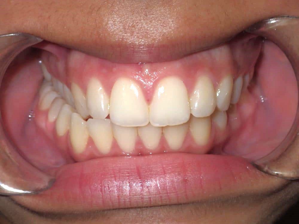 Before-patient 8