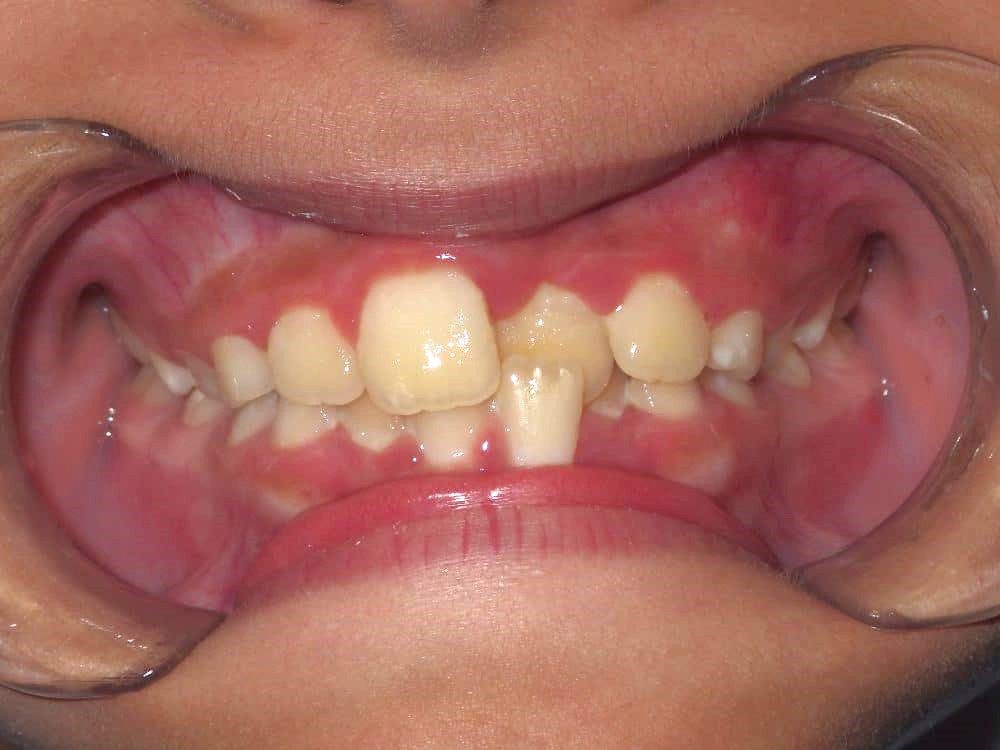 Before-patient 10