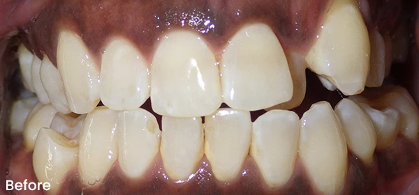 Jamal P Before Treatment