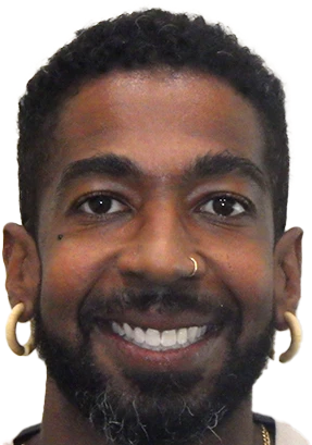 Jamal Before and After Treatment Jamal Before and After Treatment