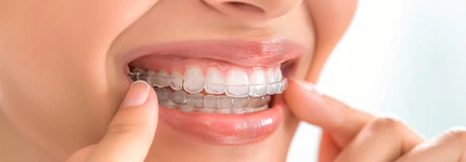 Orthodontist Miami Orthodontist Miami