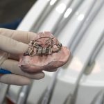 Banded and Bonded Expanders