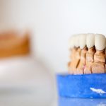 Tooth Surface