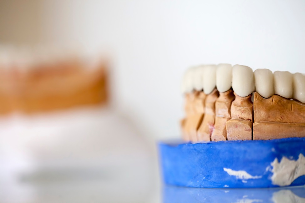 Tooth Surface