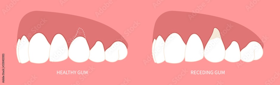 my tooth hurts when I bite down
