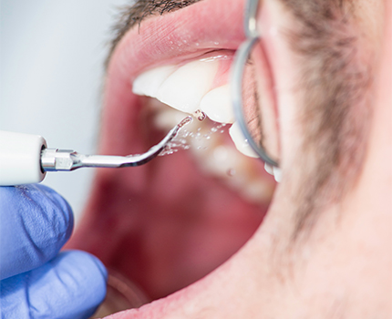 What Should A Tooth Extraction Look Like When Healing What Should A Tooth Extraction Look Like When Healing