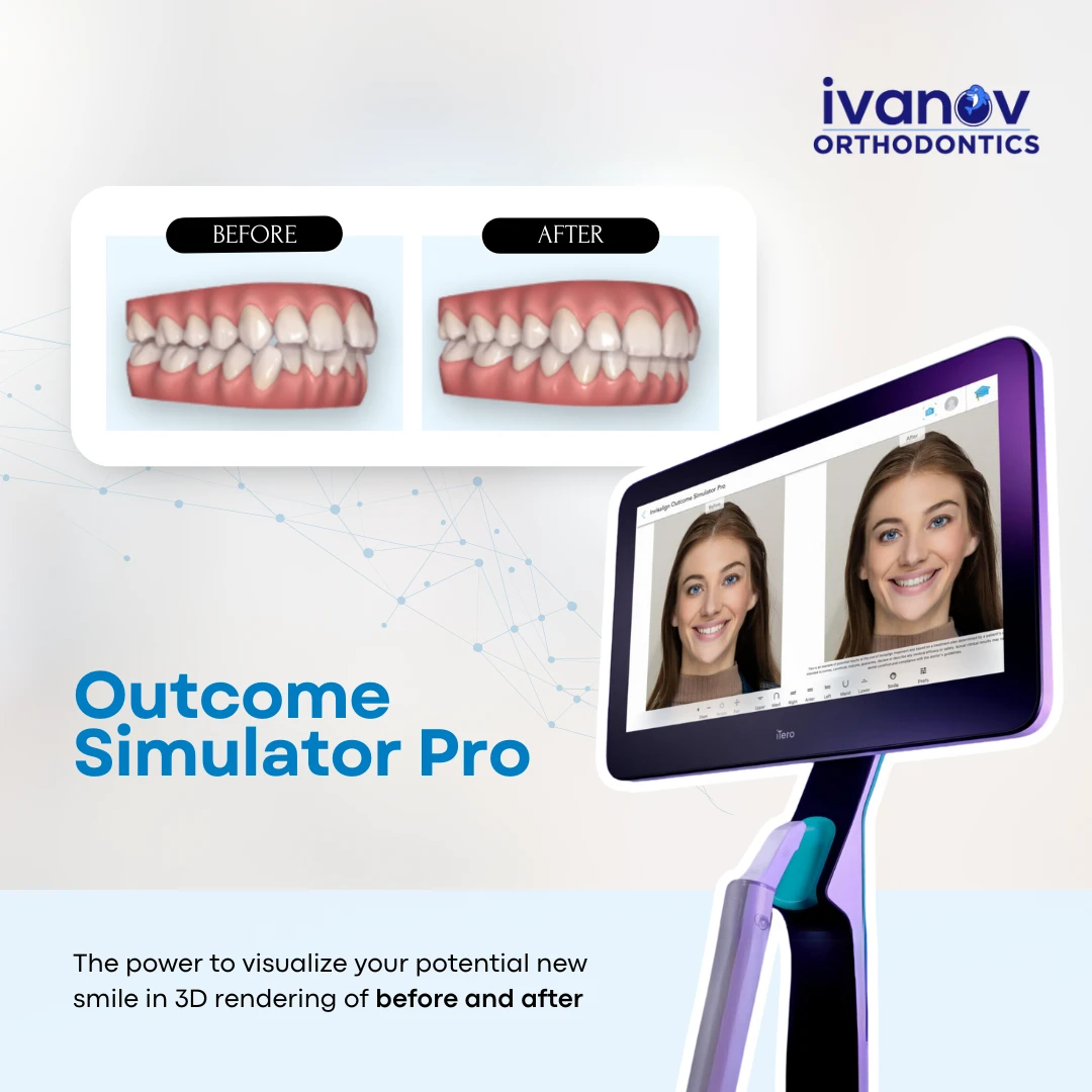 WHY IVANOV ORTHODONTICS
