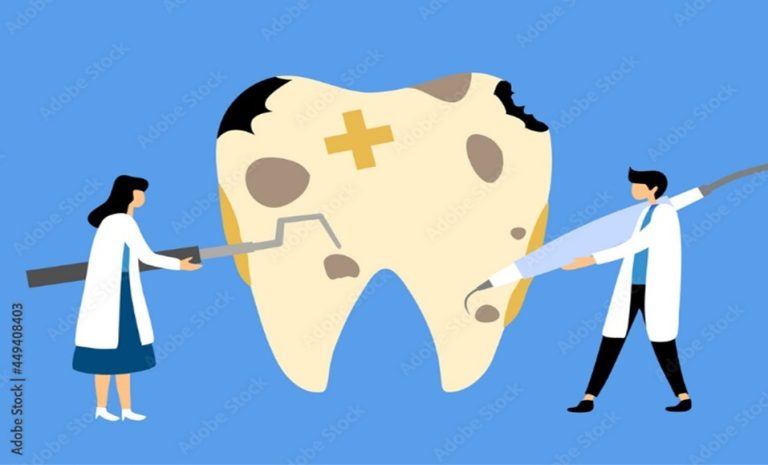brittle teeth