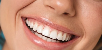 after-the-braces-come-off after the braces