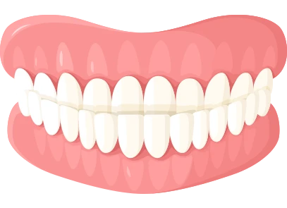 What is an Underbite What is an Underbite